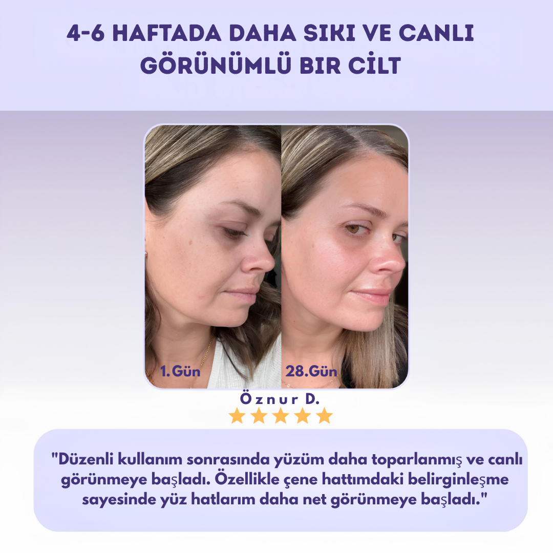 Y Lift™ Pro 4 Bölge Şekillendirici Bakım Cihazı
